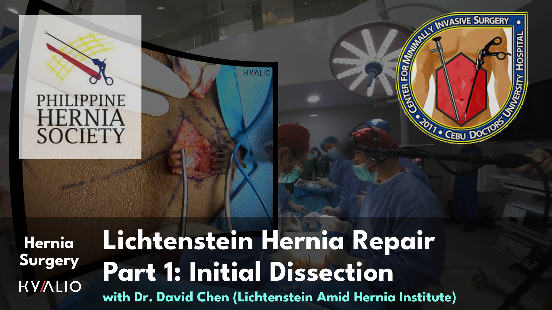 PH10_21_CDUH_DavidChen_Lichtenstein Hernia Repair_24092024_P1_TN.jpg