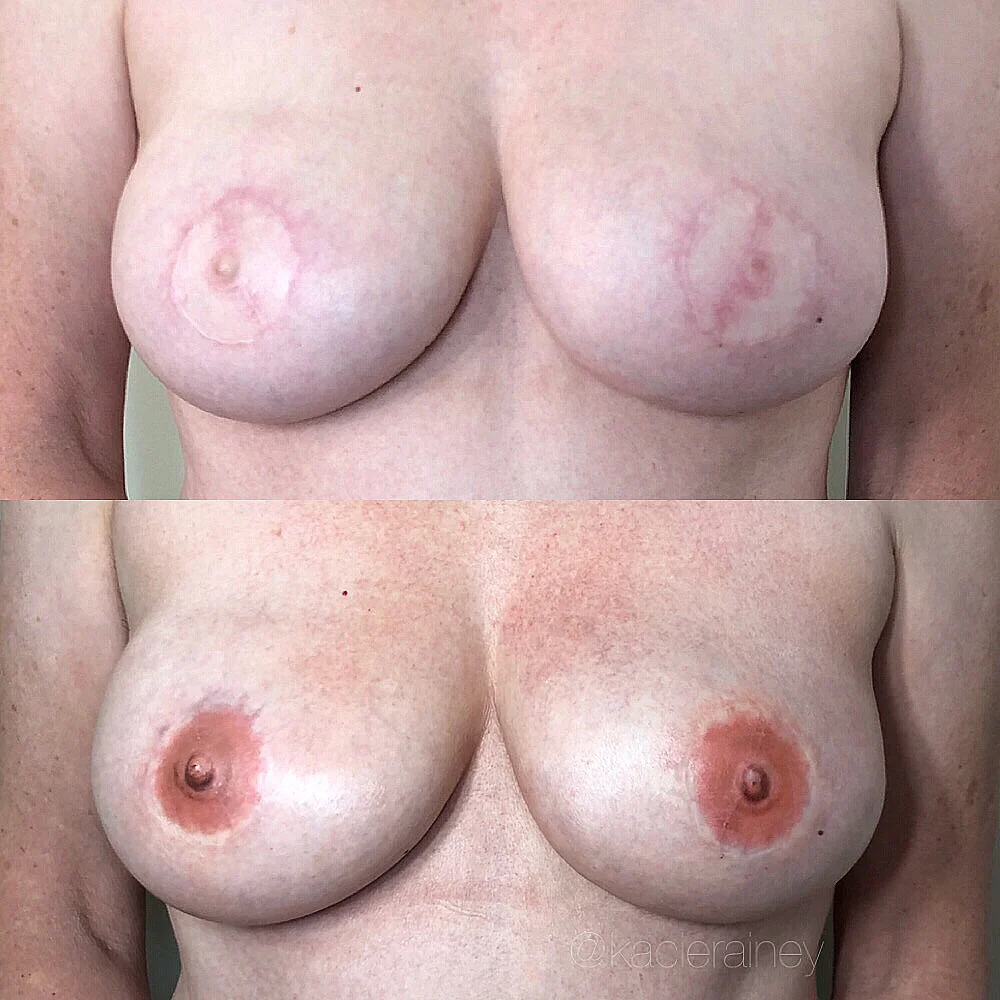 Breast Cancer Awareness Month