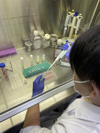 微小プラが小腸から体内に侵入か、人体への影響は