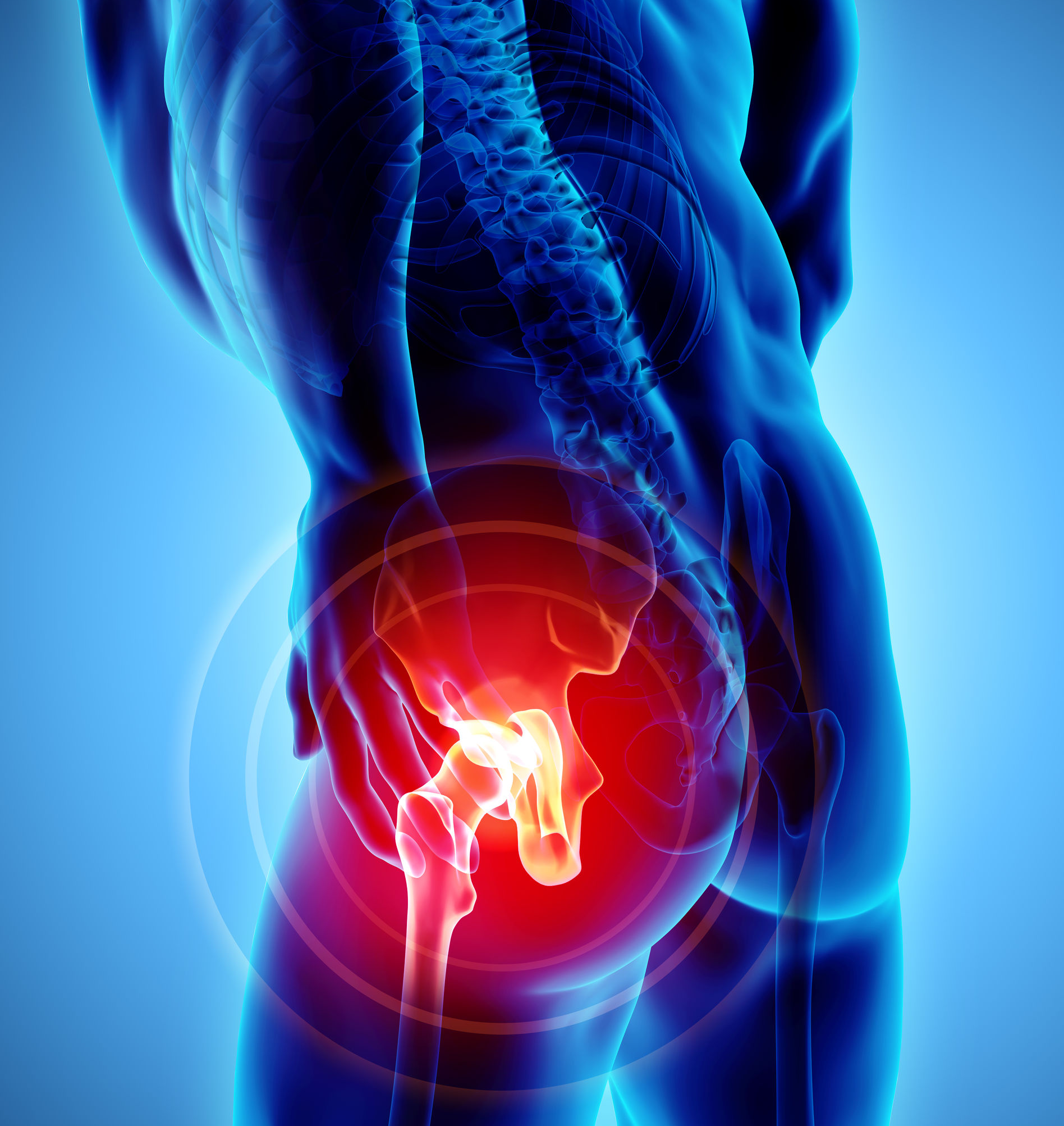 hip-pain.png
