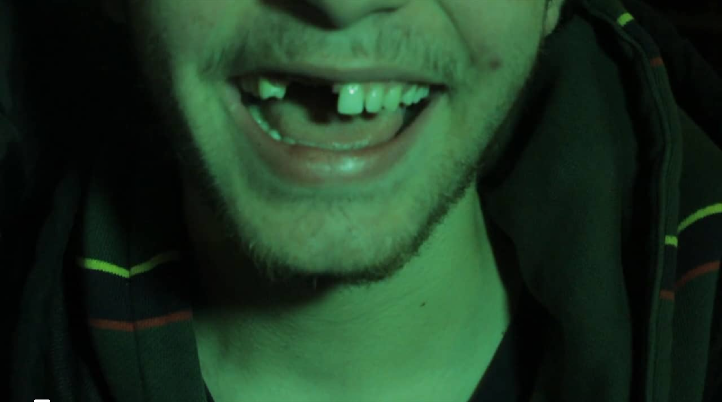 RatKing | Apologies for the sound