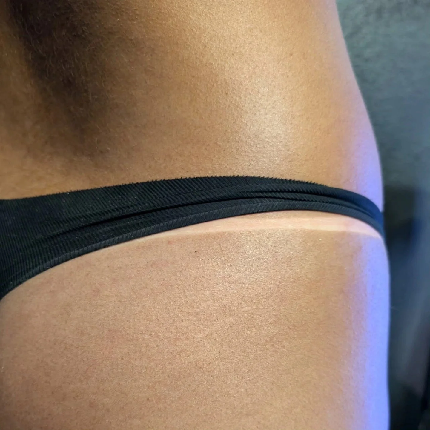 Sunless Tanning