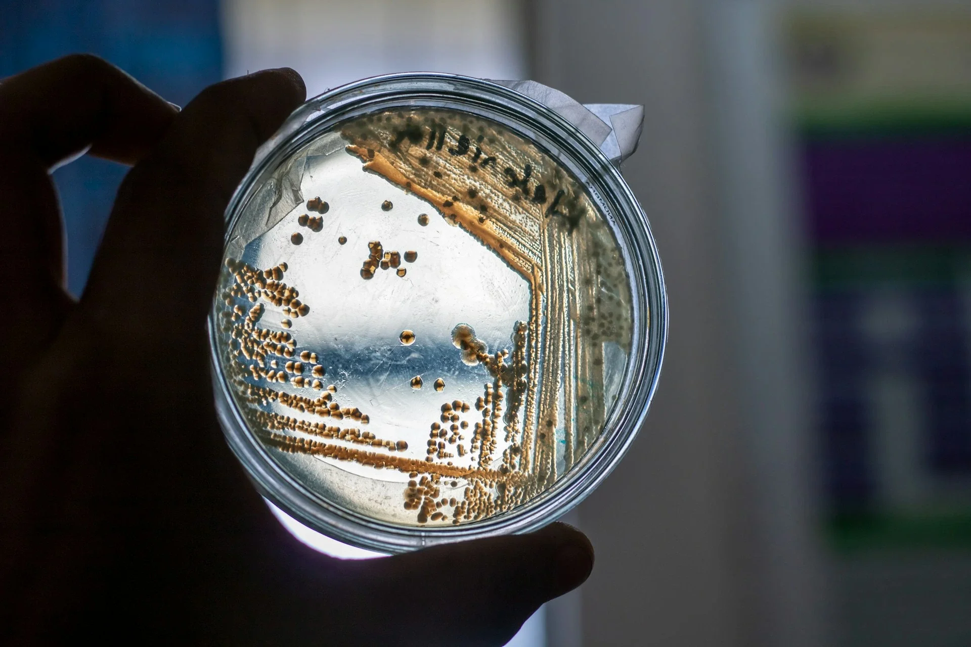 A laboratory petri dish containing bacterial colonies, held up against a blurred scientific laboratory background.