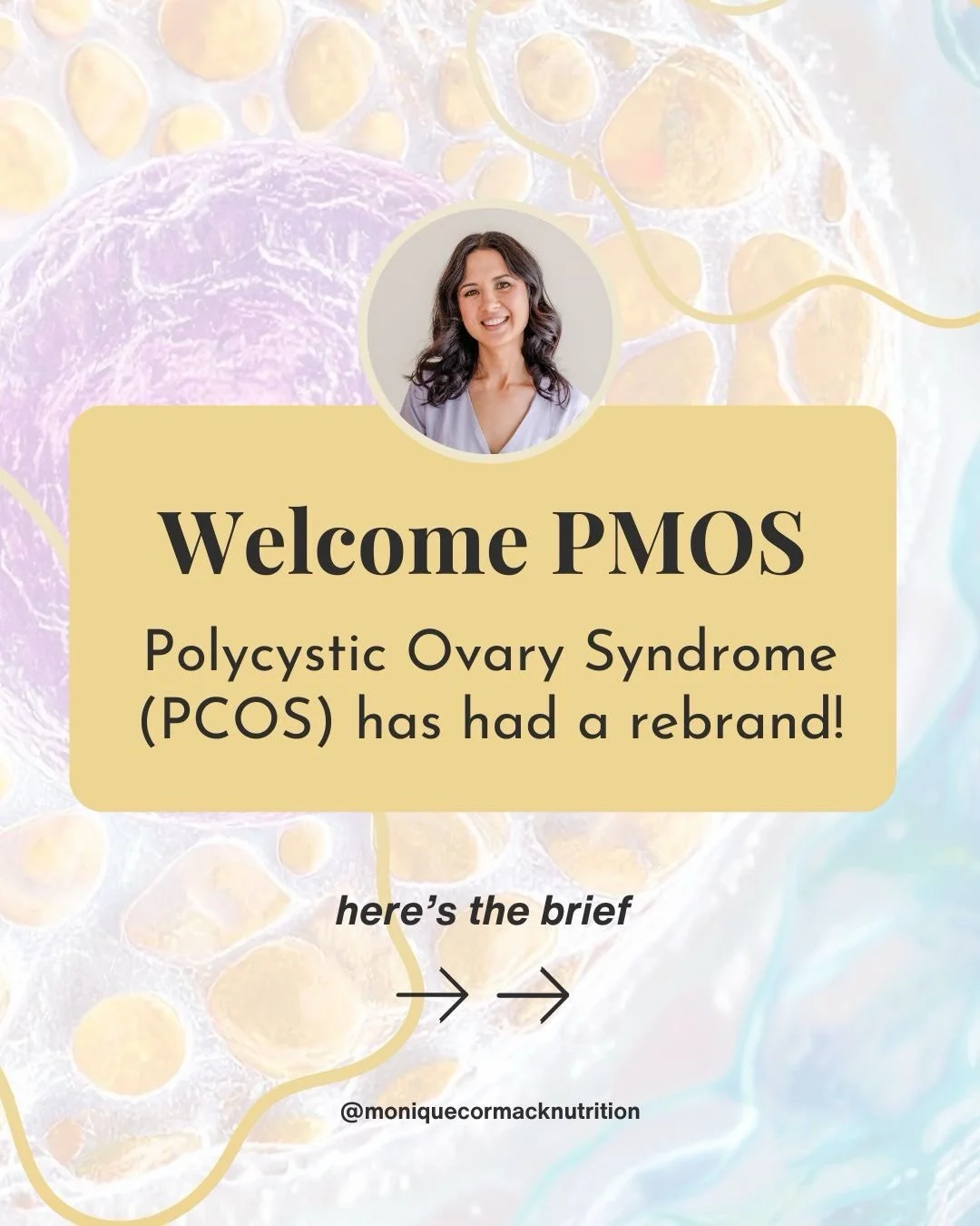 PCOS has officially been renamed!

Published in The Lancet on 12 May 2026, a global consensus of thousands of patients and health professionals agreed on a new name: Polyendocrine Metabolic Ovarian Syndrome (PMOS).

And it&rsquo;s not just a rebrand 