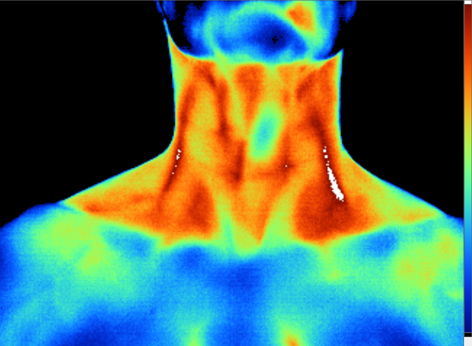 Neck Anterior F H.PNG