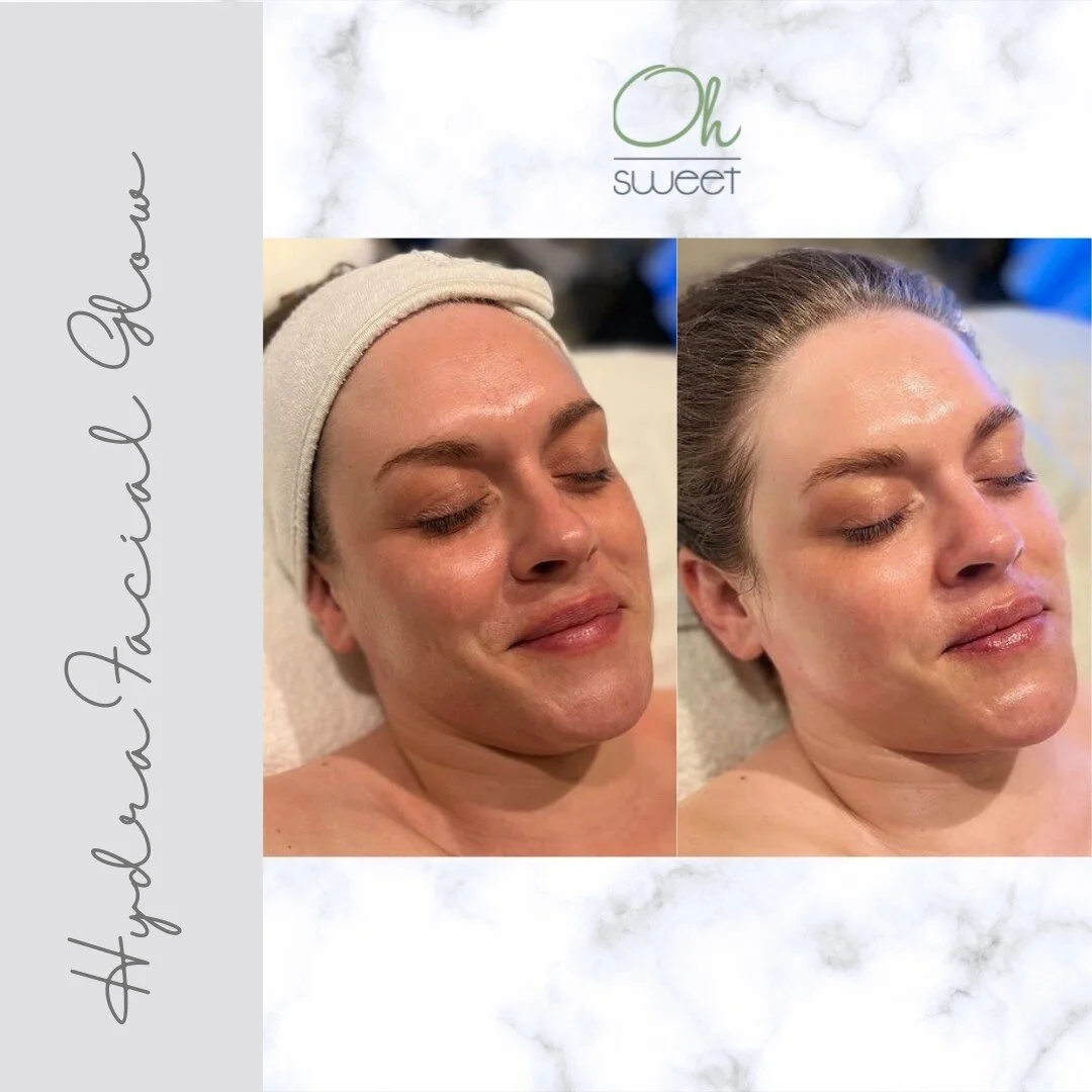 That STUNNING HydraFacial Glow 😍⁠
⁠
CLEANSE + PEEL⁠
Uncover a new layer of skin with gentle exfoliation and relaxing resurfacing.⁠
⁠
EXTRACT + HYDRATE⁠
Remove debris from pores with painless suction. Nourish with intense moisturizers that quench ski
