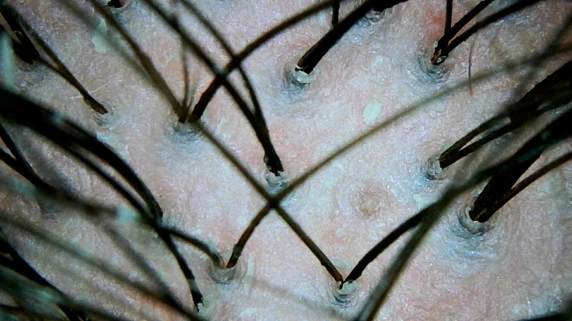 When to see a Trichologist