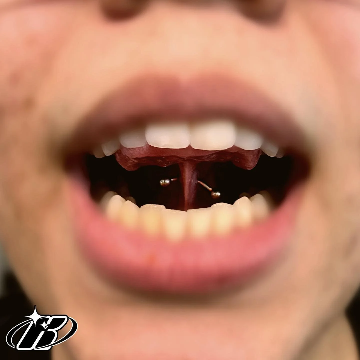 A fun walk-in! You&rsquo;ve probably heard of the smiley, but have you heard of the frowny or the tongue web piercing? Done this one a while ago and finally found the picture I took. 

#piercings#piercing#pierced#bodypiercings#jewlery#piercedgirls#pi