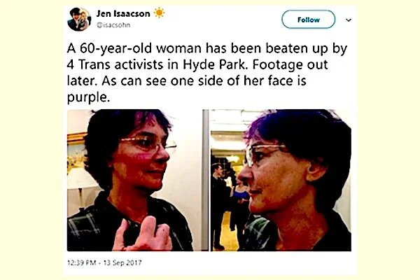 60-Year-Old Woman’s Face Beaten By Trans Activists Trying to Stop a Debate on Gender the Activists Had Already No-Platformed 