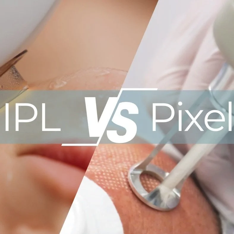 IPL vs Pixel