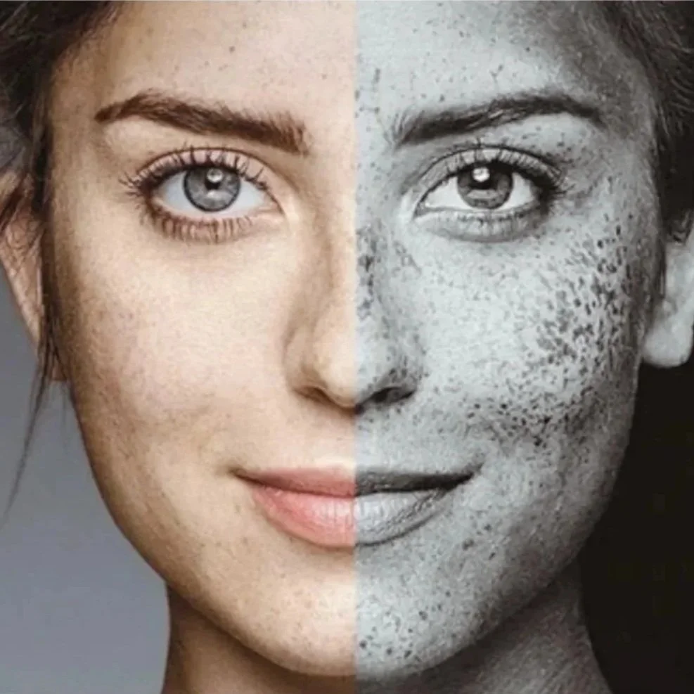 Can Sun Damage Be Reversed?