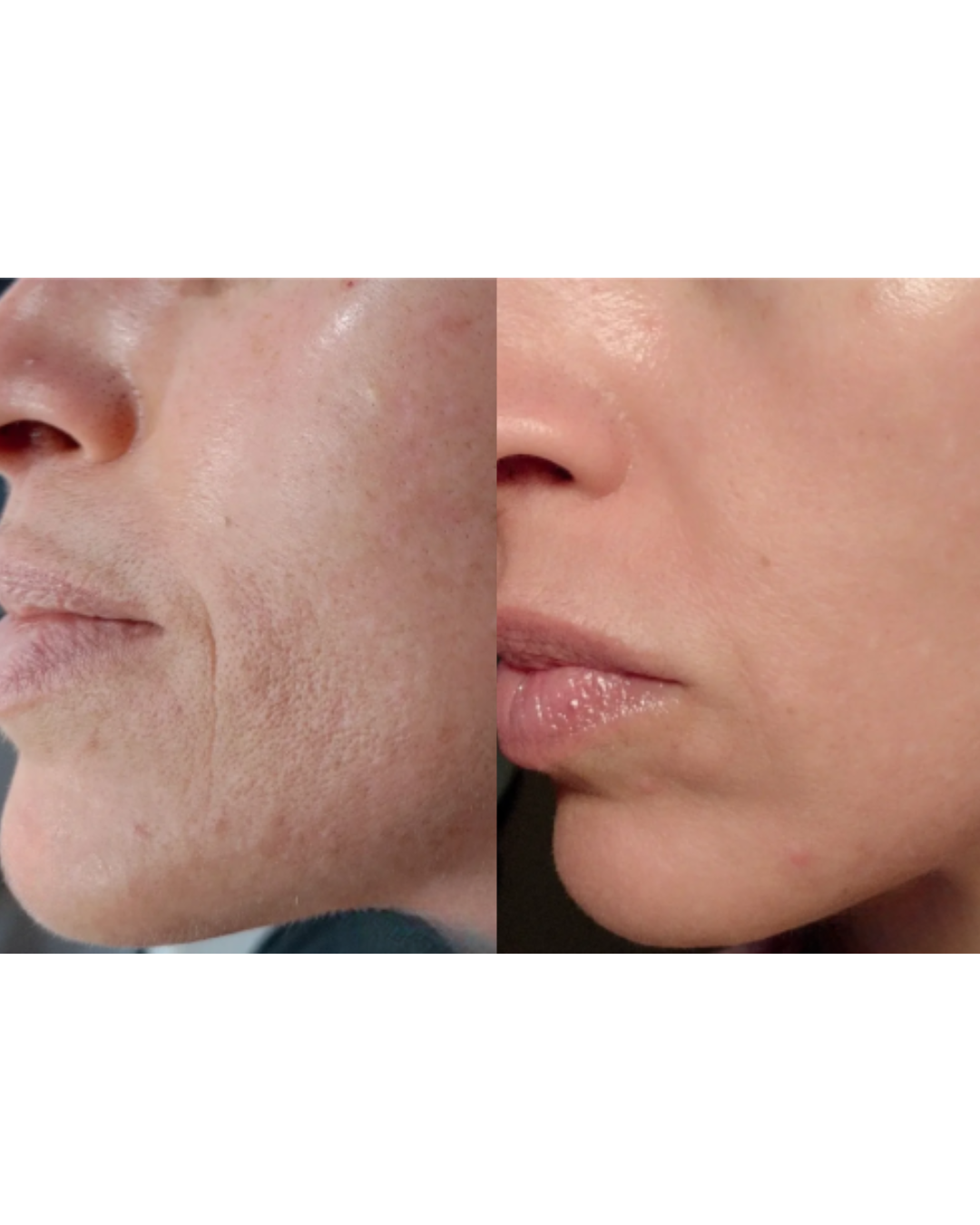 CollaSkin