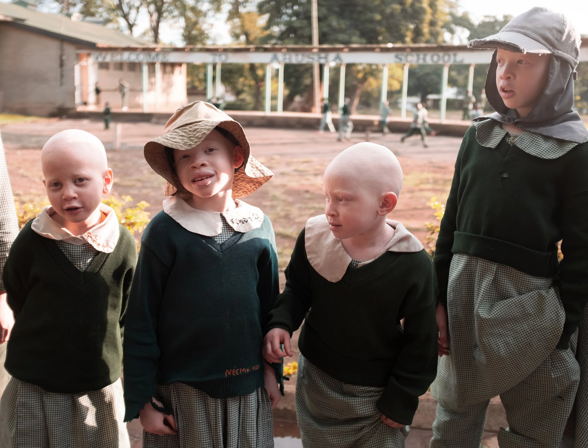 Skollov för barn med albinism