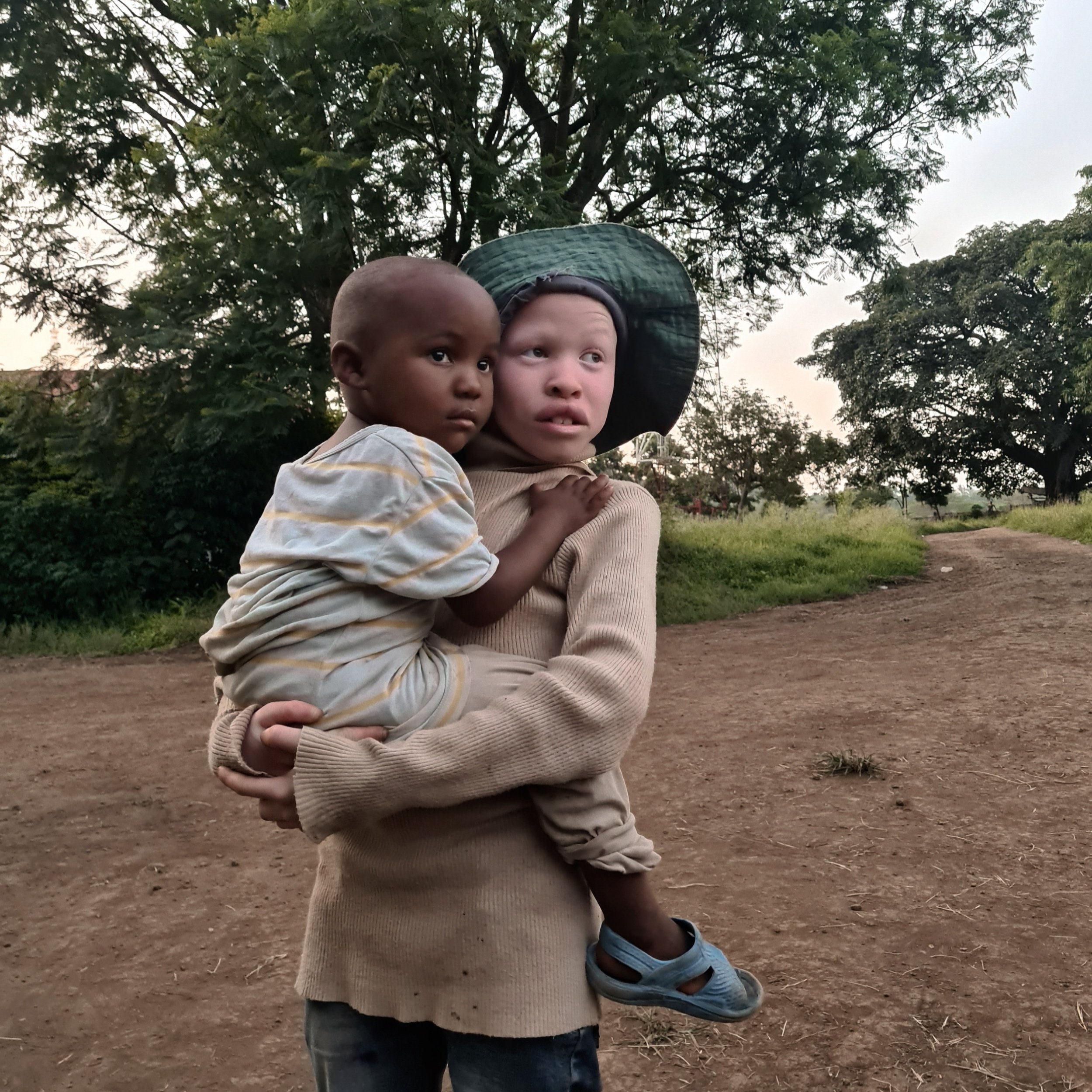 International Albinism Awareness Day 202