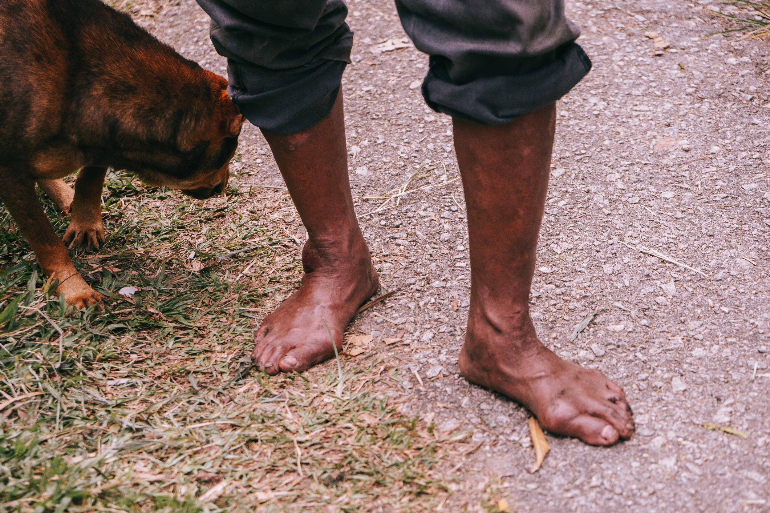  Like the Aboriginals of Australia, the Orang Asli live off the land. They rely on the forest for food, resources, and medicine. Our guide told us that they don’t go to the hospital if they are sick or injured.  I looked at Michael Jackson’s ankle an