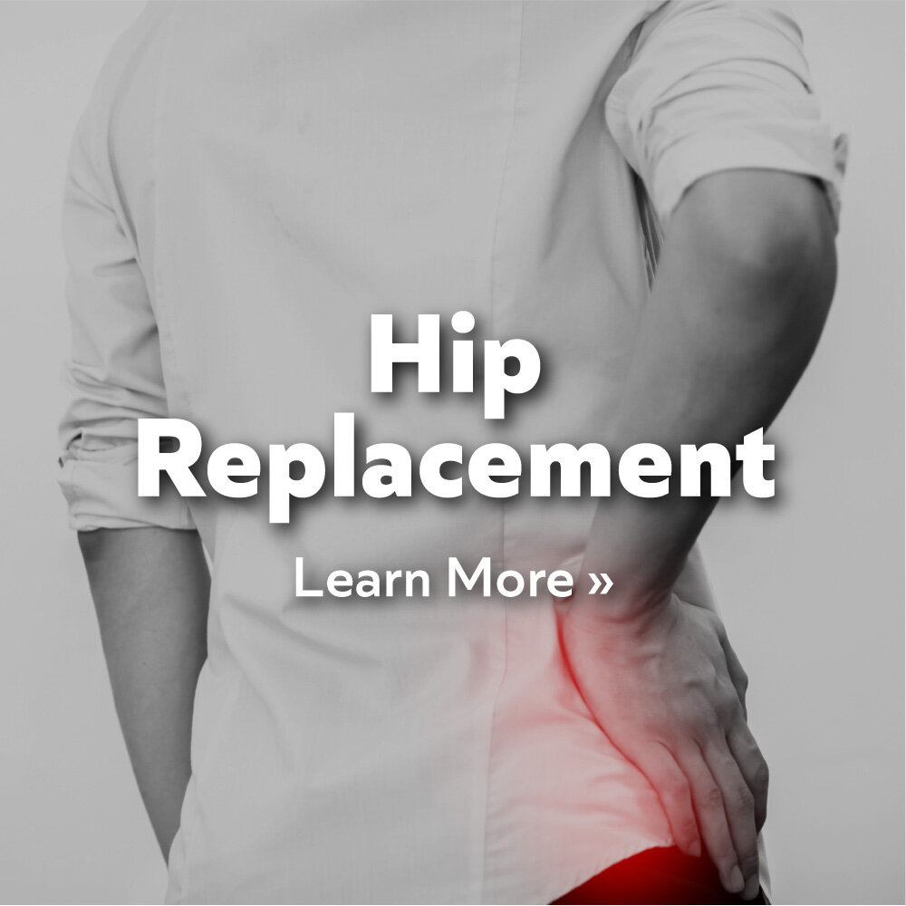 Hip Replacement Los Angeles