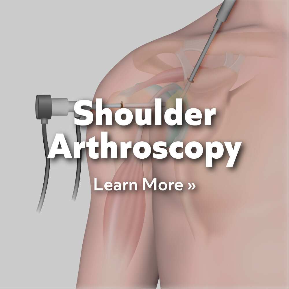 Shoulder-Arthroscopy.jpg