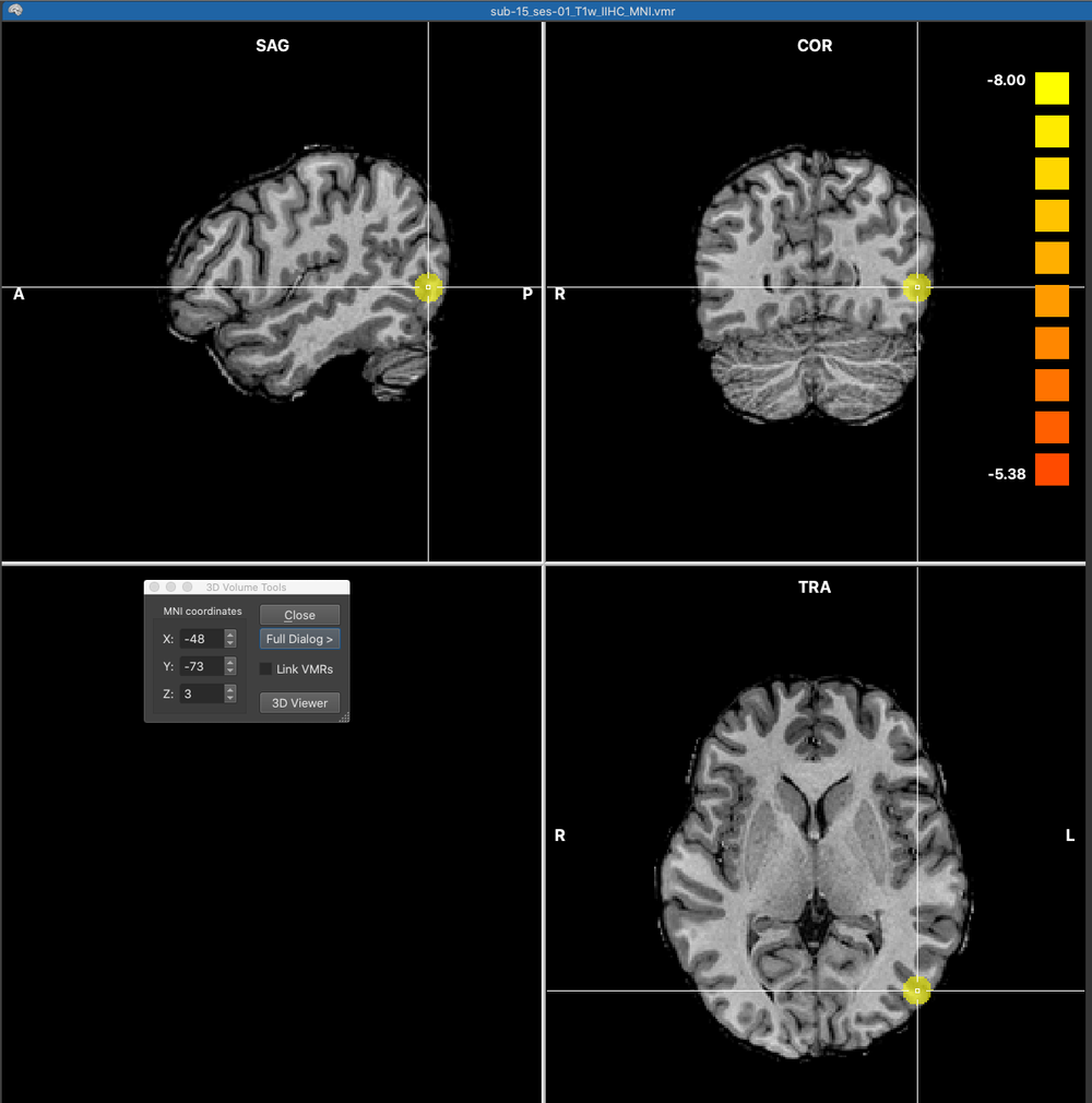 Tutorial 7: ER&Decon — NEWBI 4 fMRI