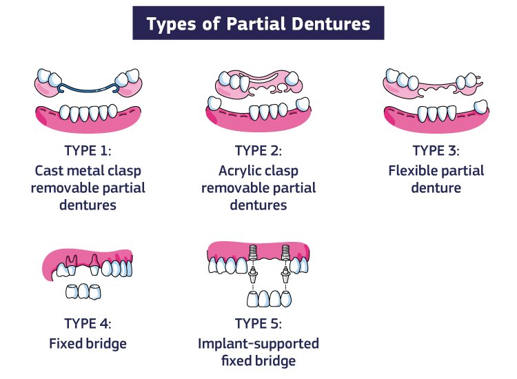 Dentures Orleans Wood Dental dentures-orleans-wood-dental