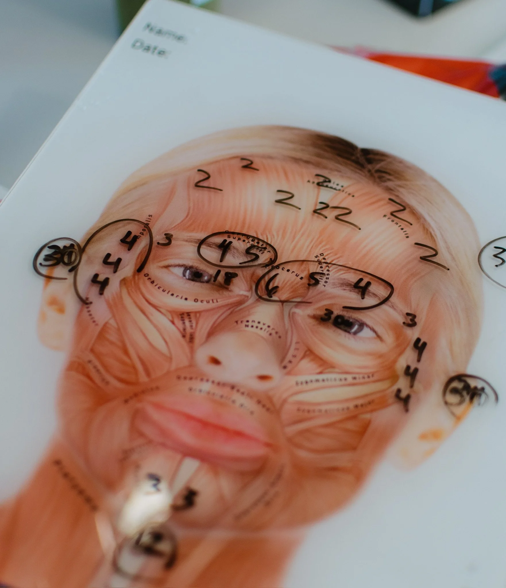 image of a face marked for injections with botox, dysport, jeuveau