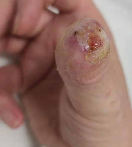 VCPhoto Vaughn Thumb Right c 220405b copy.jpg