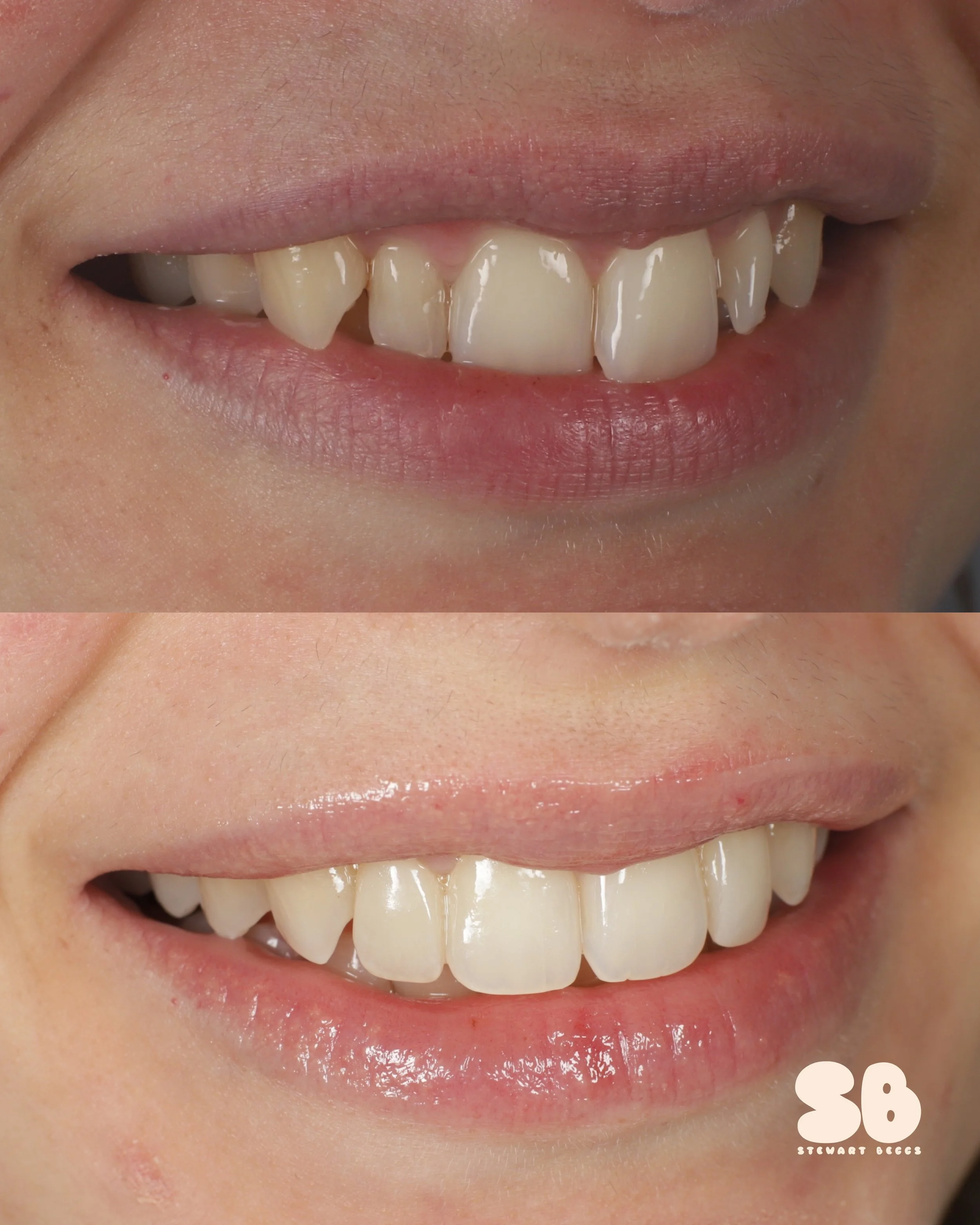 2026-02-09 - collage_2up - eddtr-3.jpg