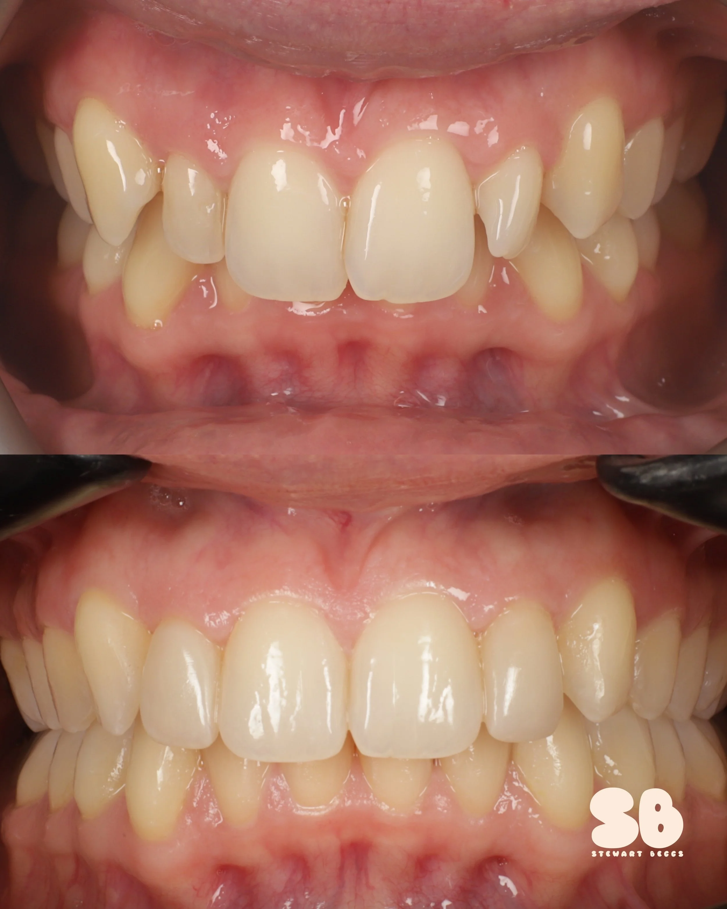 2026-02-09 - collage_2up - eddtr-5.jpg