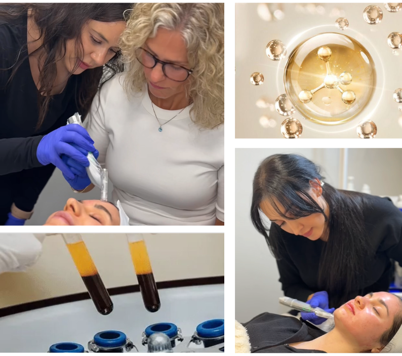 PRP/Exosomes Microneedling, Hair PRP &amp; Polynucleotide Treatment Training
