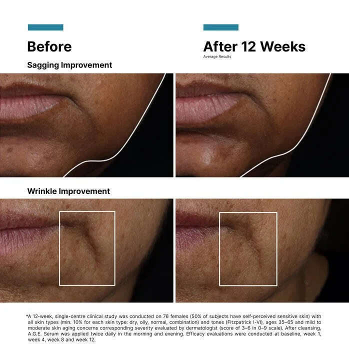 WFP-11471051_AGEIntULTRASerum_Slide_12_Before+_After 1.jpg