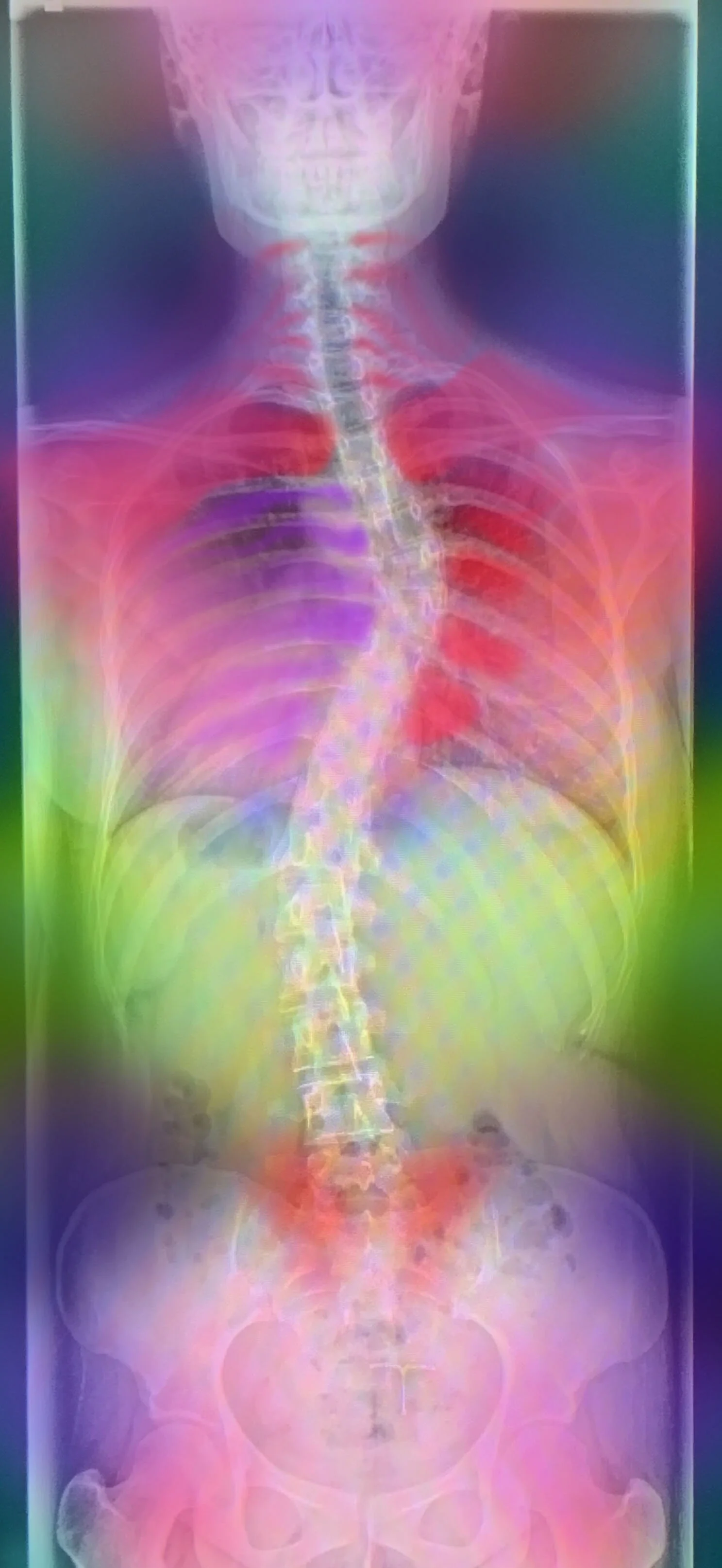 xrayptg1.jpg