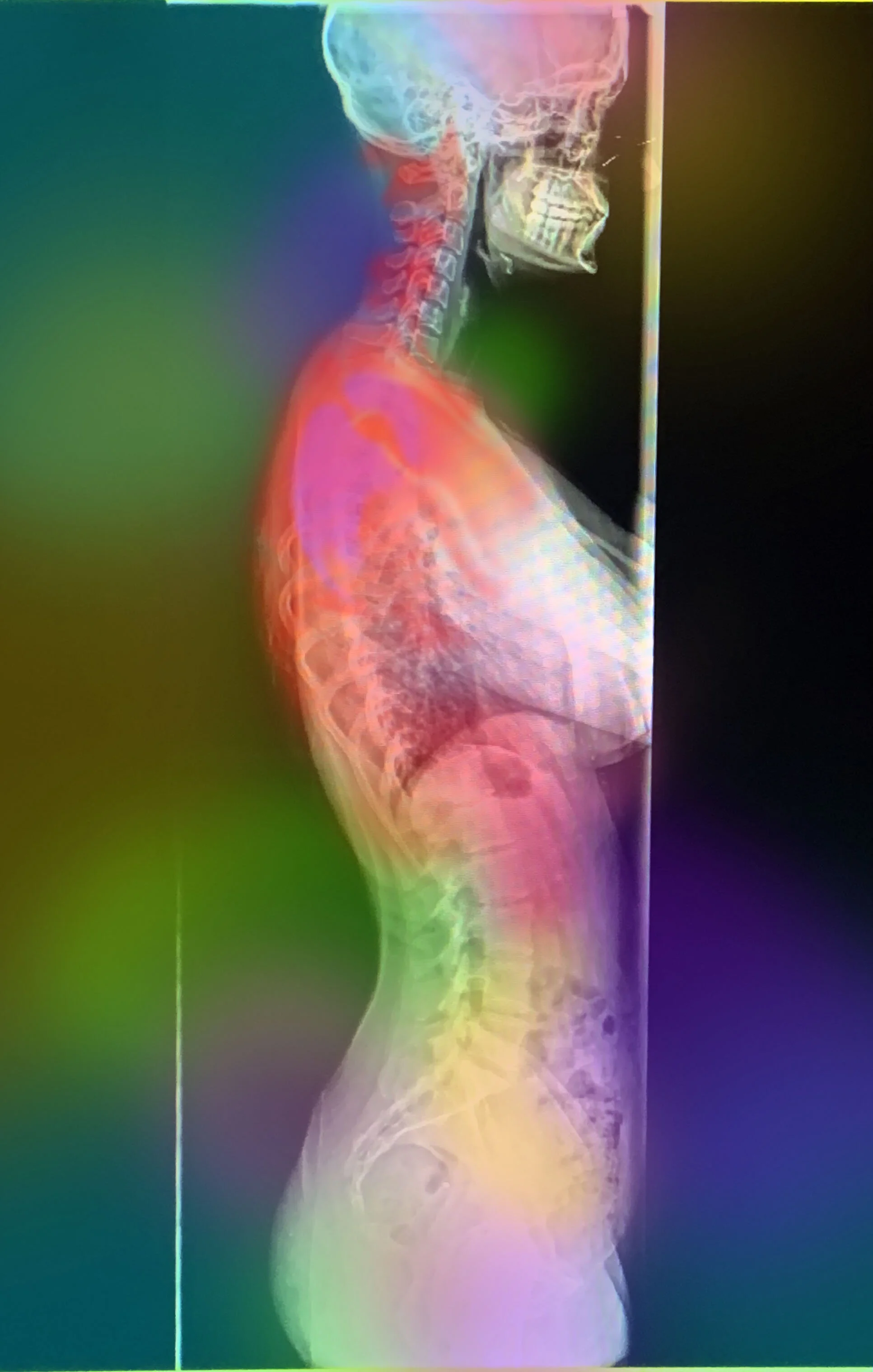 xray painting 1 side.jpg