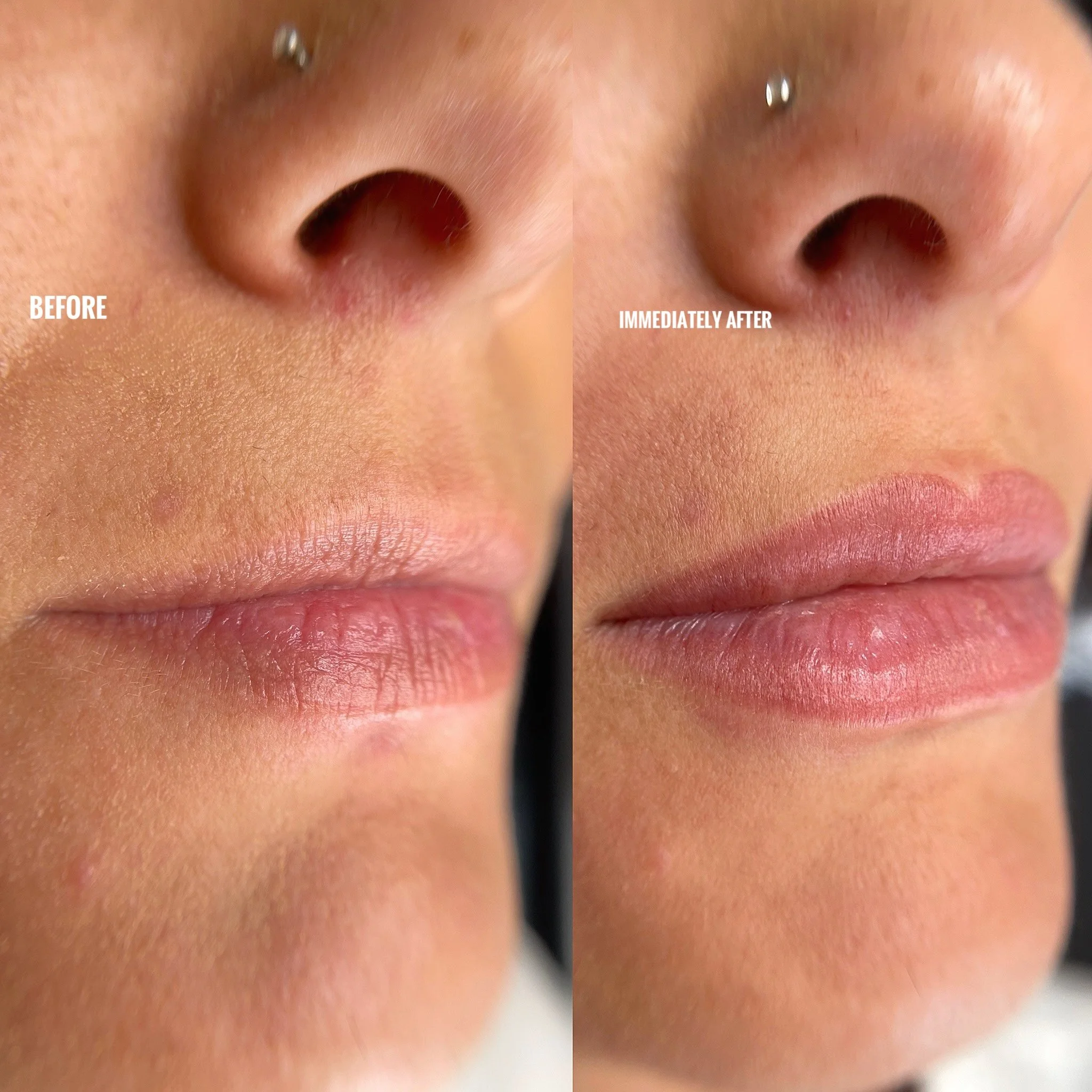 Lip Blush 