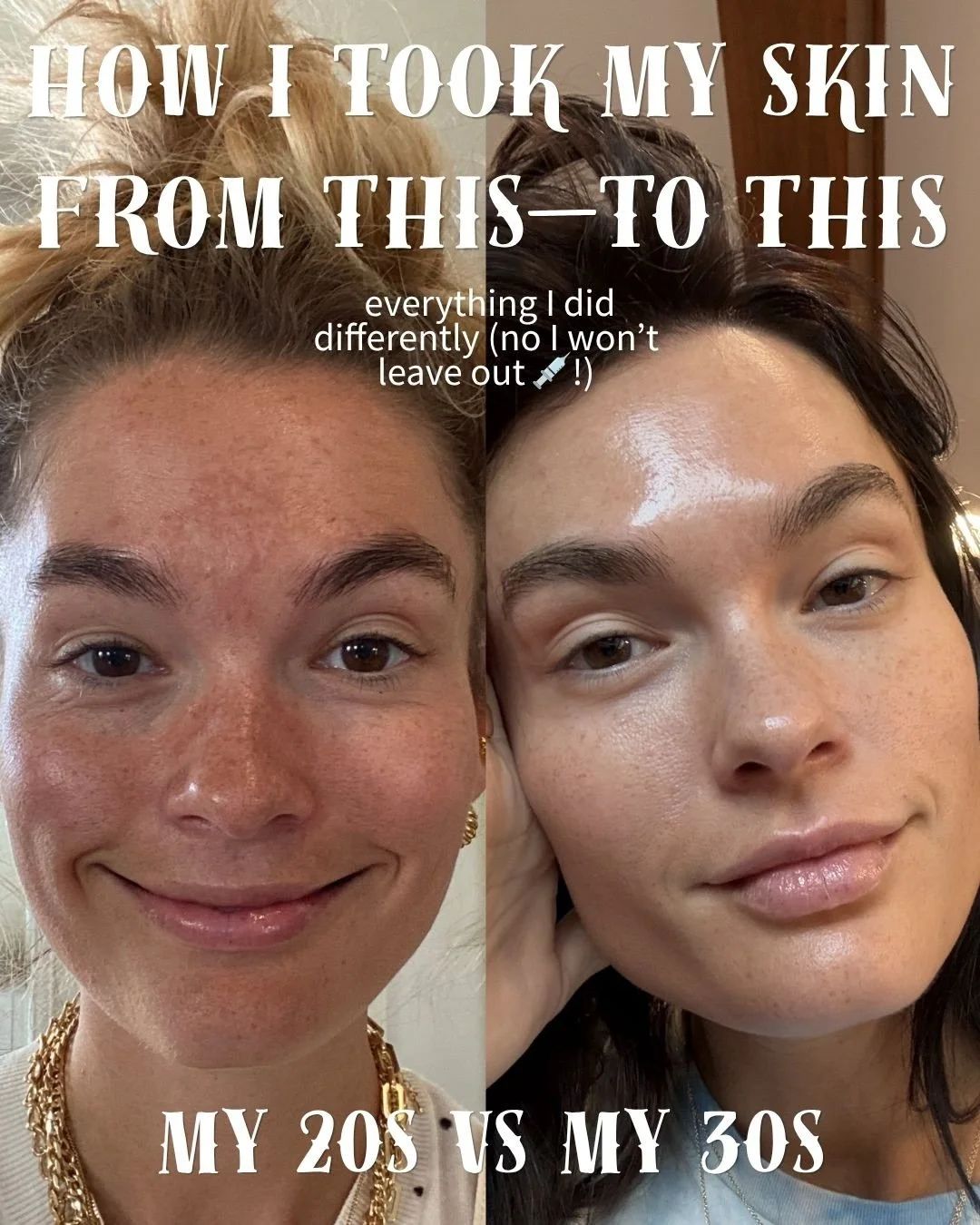Comment SKIN for links and a PDF to everything I use with details and descriptions so you have everything in one place 🫶🏻✨
After being pregnant with my son Max, my skin was dry, tired and full of dark spots. I set out to rehab my skin from a place 