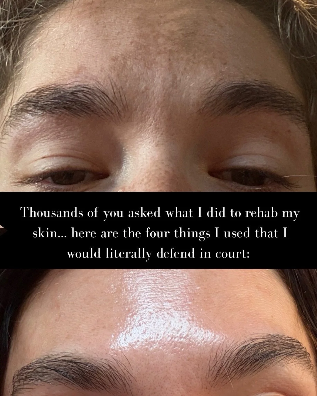 I made this MUCH simpler for you&hellip; my TOP FOUR favs in one link - comment &ldquo;ME&rdquo; 🫶🏻🫶🏻🫶🏻 if you want to rehab your skin with meeeeeee!
#skin #skincare #skingoals #skincareroutine