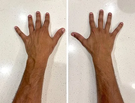 arms.jpg