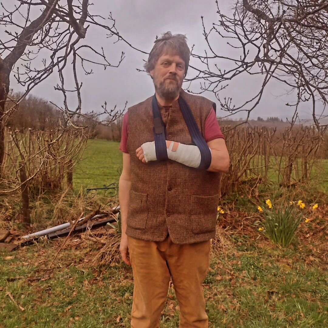 Bill ( me) being a foolish gentleman has just gone &amp; smashed his arm up. This means that Chava won't be at CraftCon this weekend with the @cider_women talking about climate resilient orchards, which I know she's really sore about, and that we pro