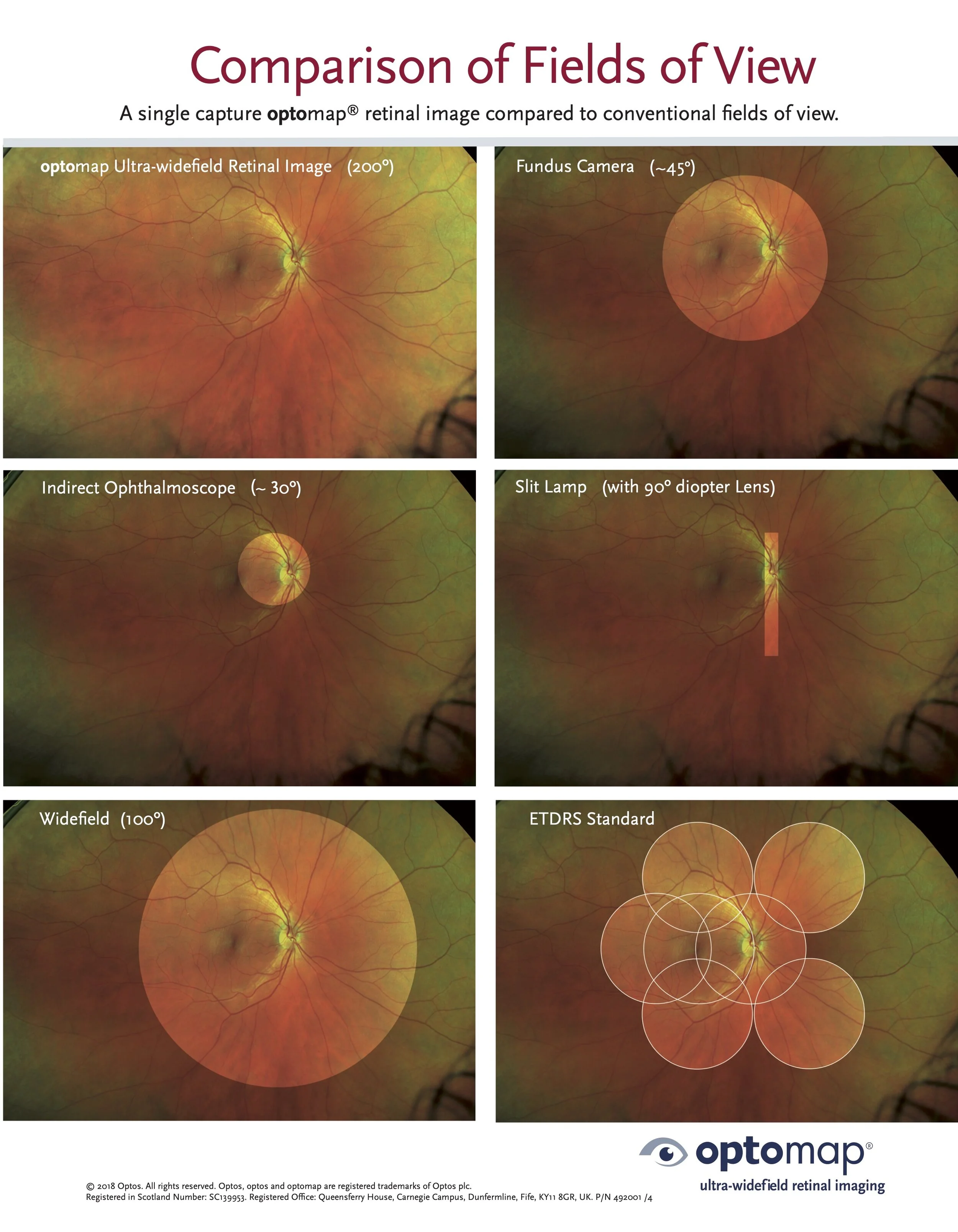 comparison-field-of-view.jpg