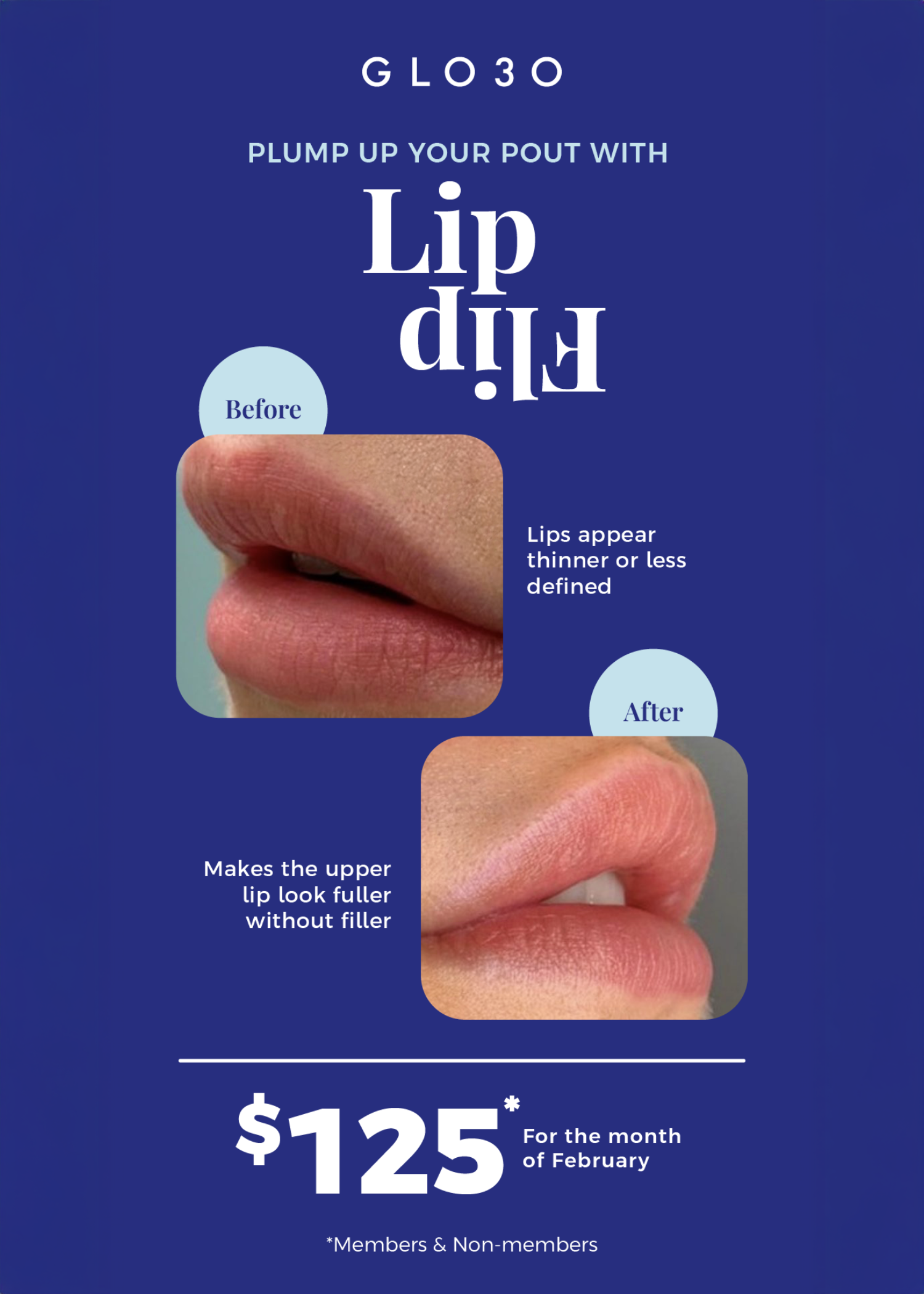 Glo30:💋 LIP FLIP PROMO – ONLY $125! 💋