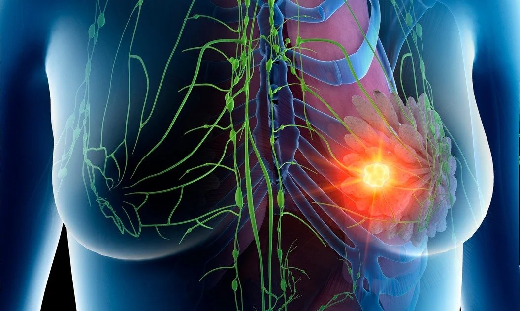 Beyond One-Size-Fits-All: Exploring Personalised Breast Cancer Screening Strategies