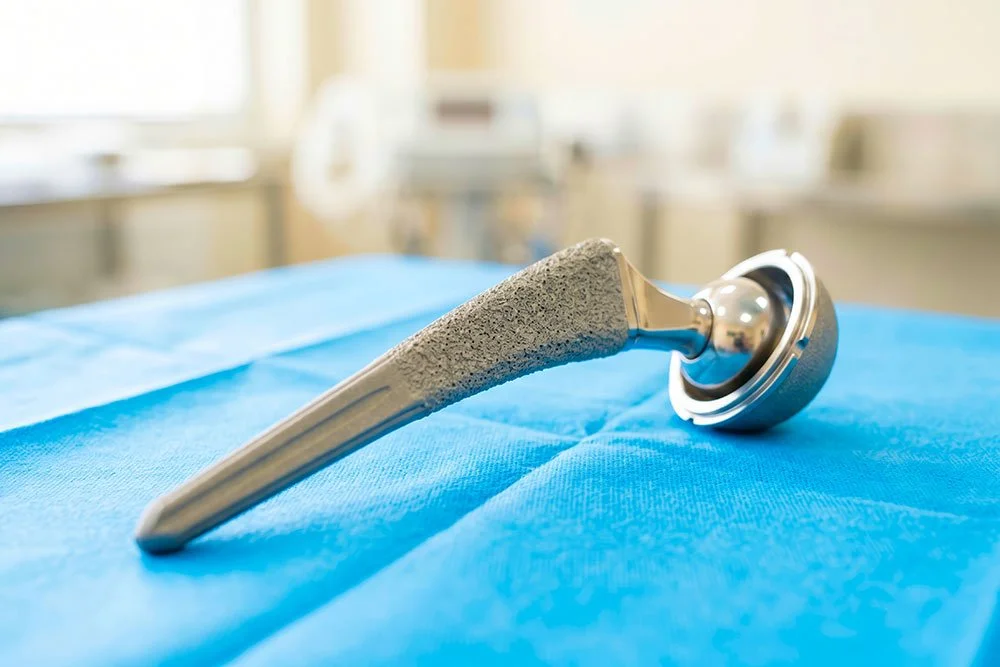 How Common Is Metal Allergy After Knee or Hip Replacement?