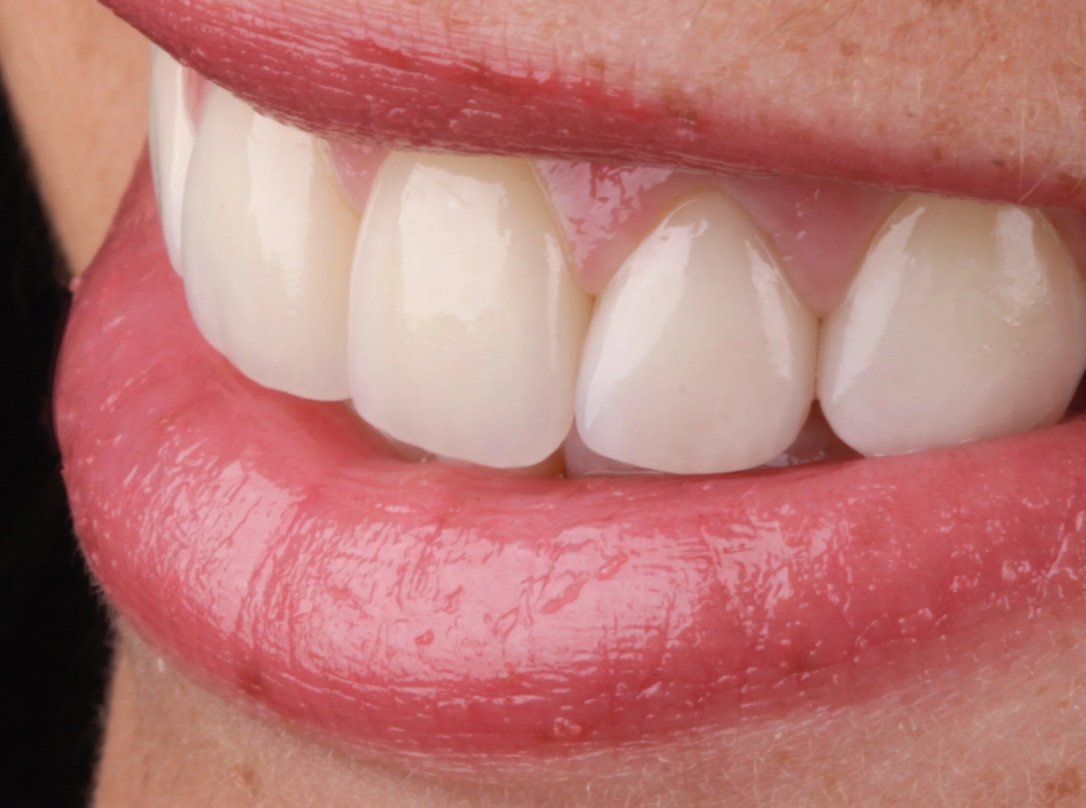 Lipstube: Get Results You'Ve Always Dreamed Of - lzxuc6w