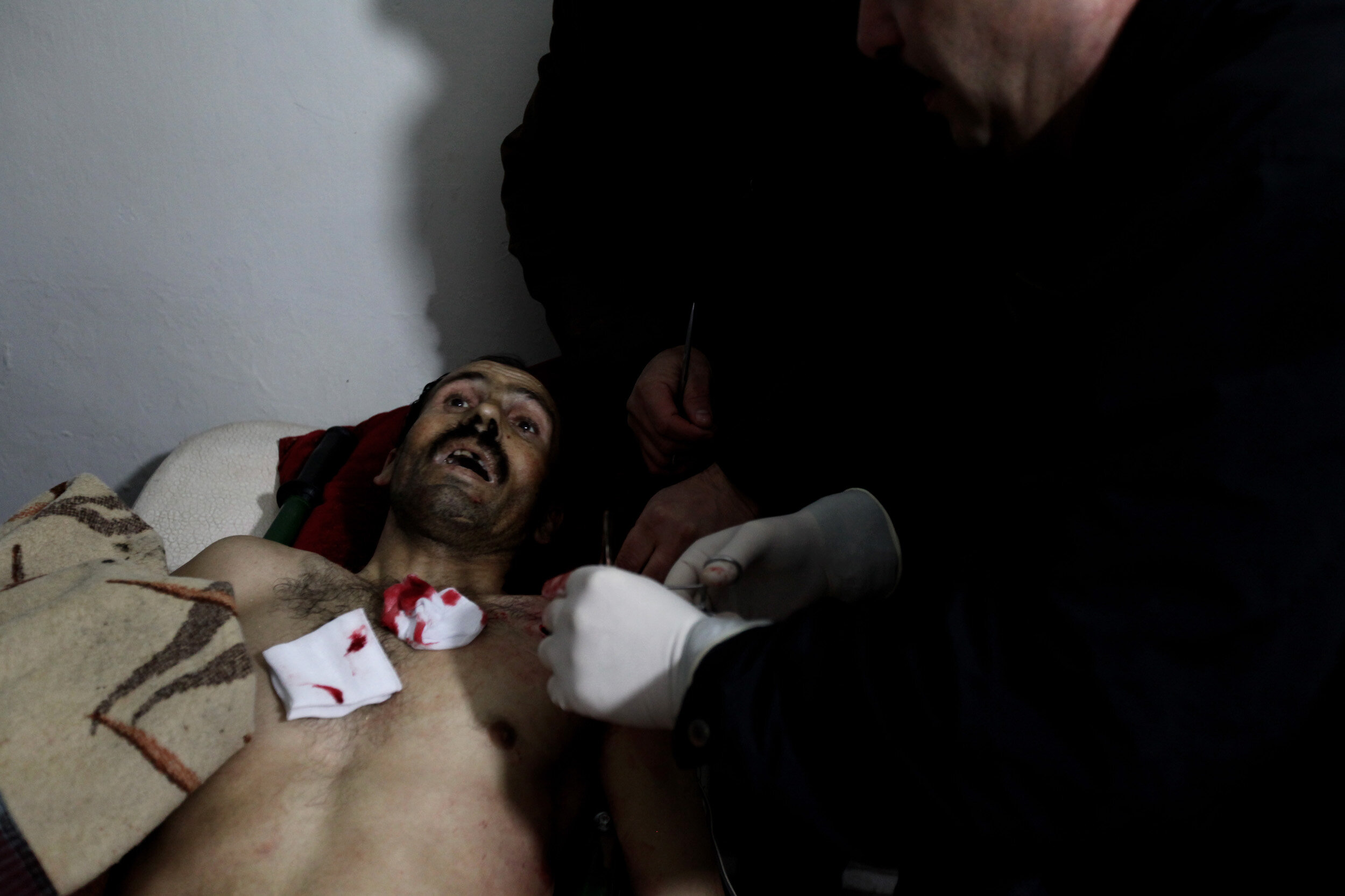  Victim of a ‘nail bomb’, makeshift medical center of Karm al-Zaitoune, Homs, Jan 26/2012. 