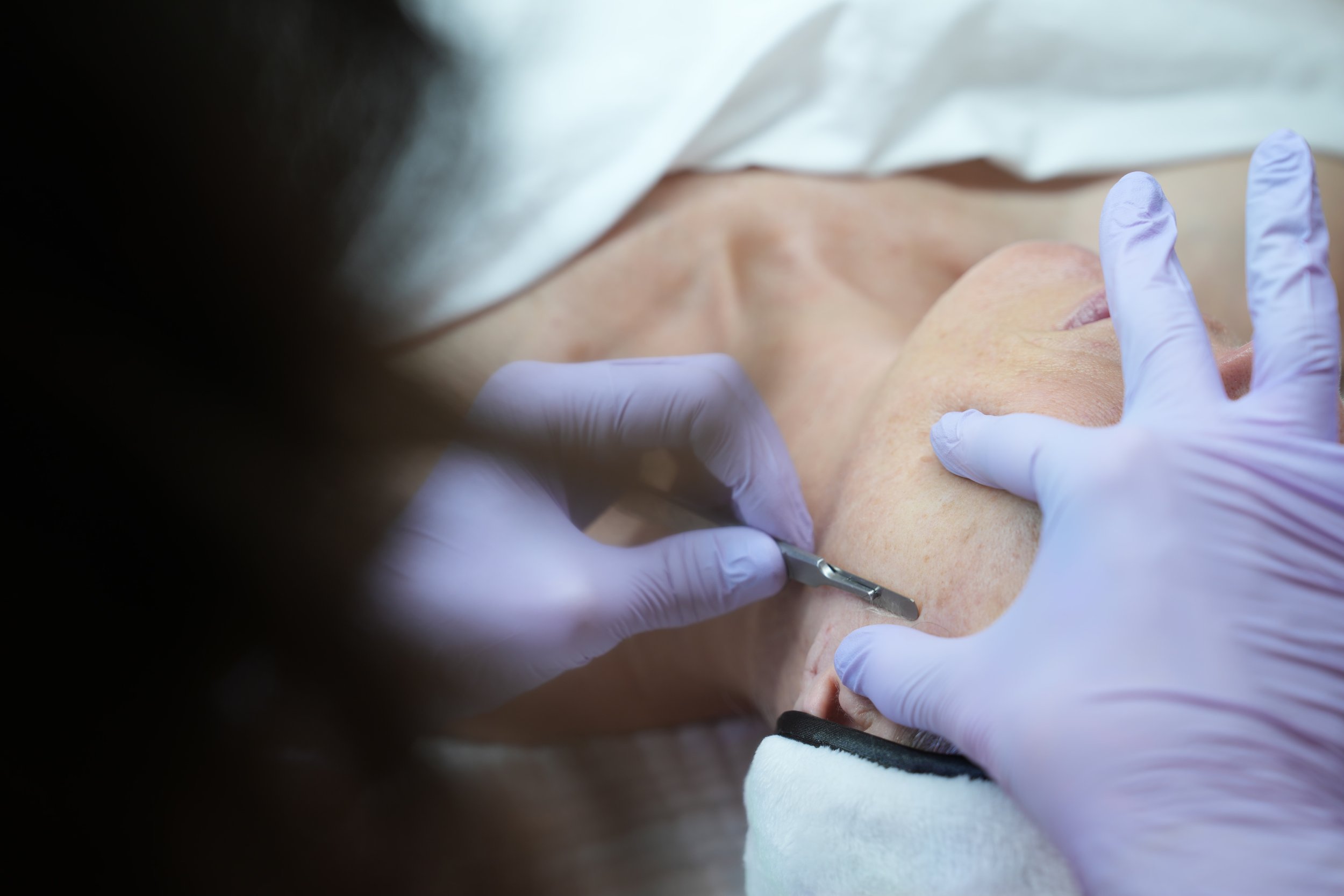Dermaplane
