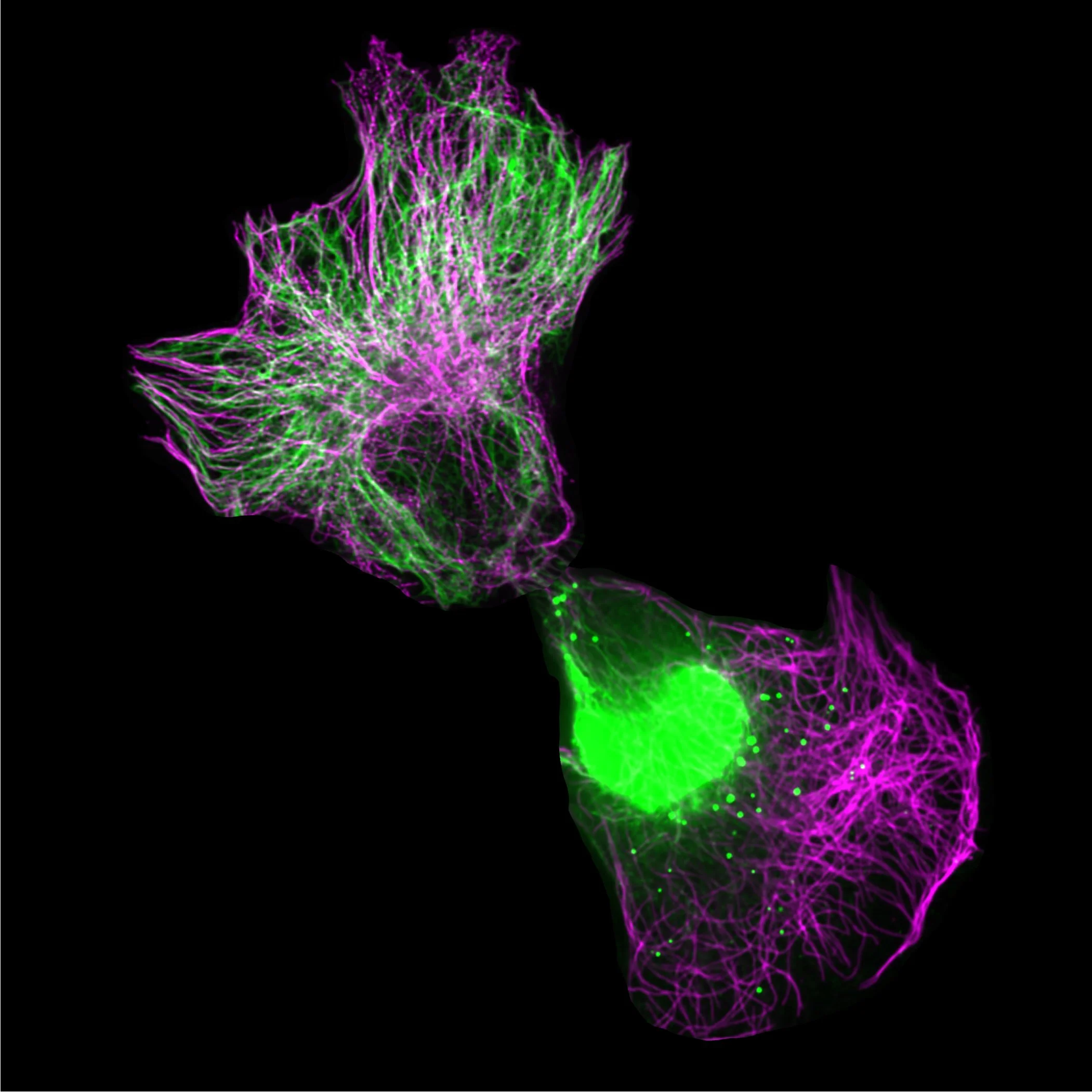 Intermediate Filaments In A Cell