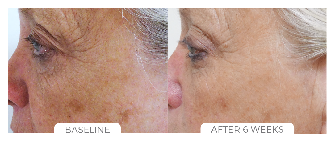 Skin Brightening System Before & After Photo 2.png