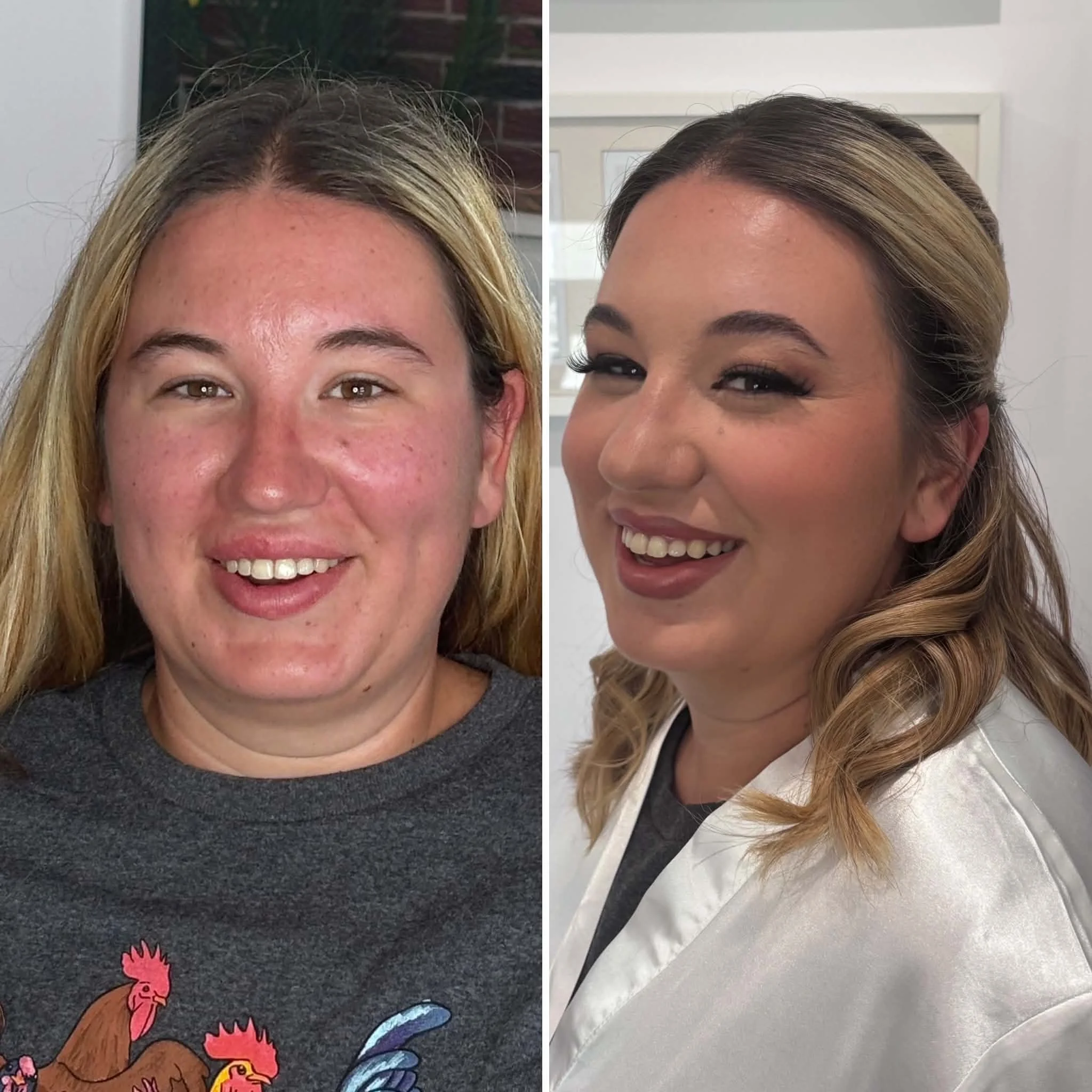Before and After