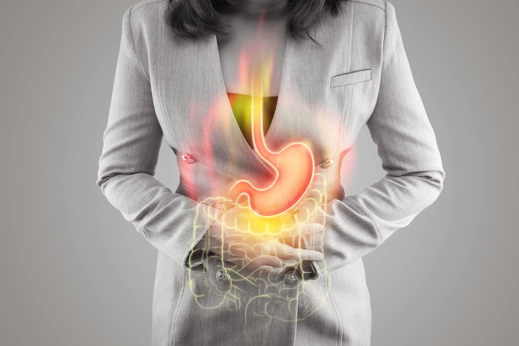 Beyond the Antacid: Why Your Reflux Might Be a Gut Problem (Not Just an Acid Problem)