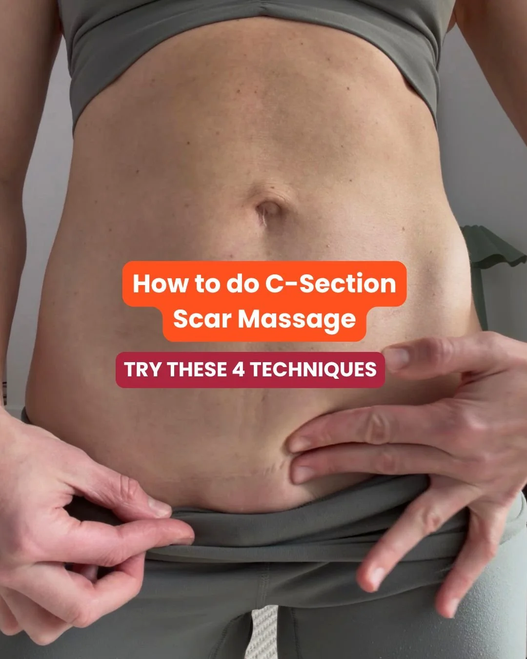 How to Massage Your C-Section Scar: 4 Simple Techniques