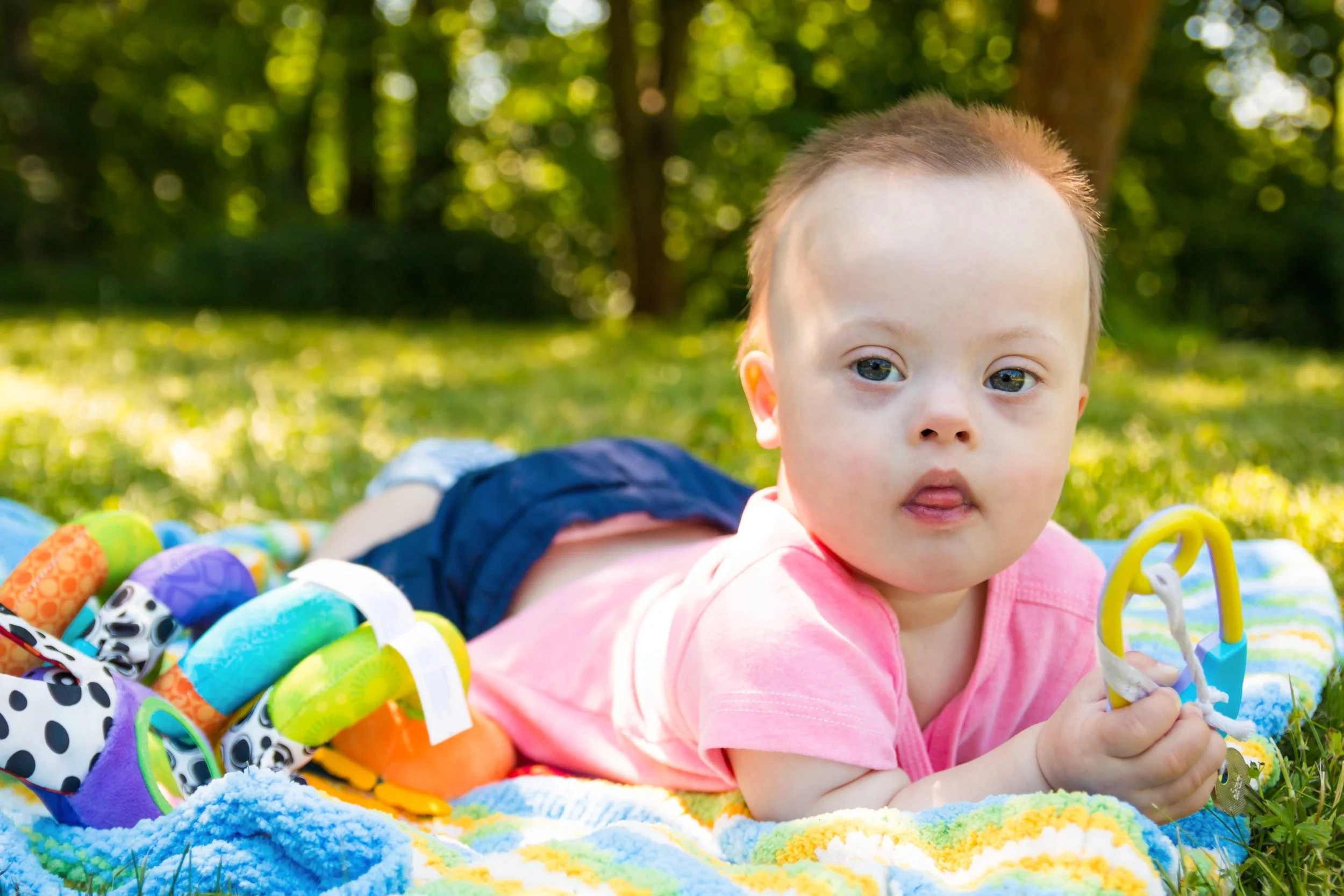 Baby Boy with Down Syndrome Lying on Blanket