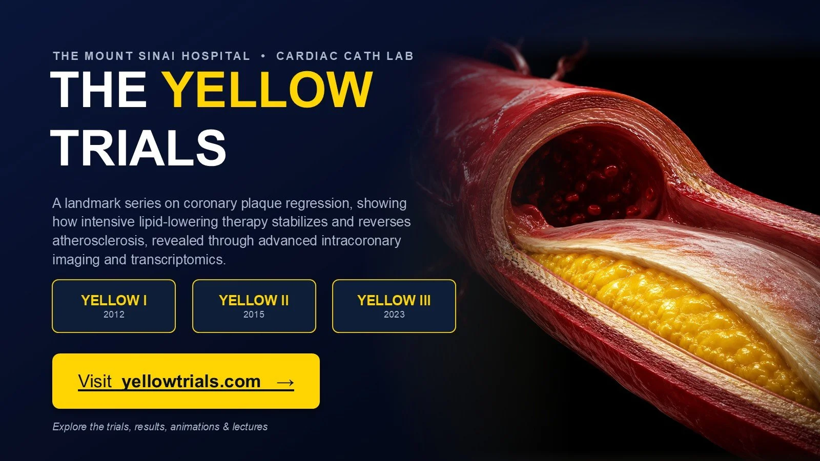 YellowTrials Banner.jpg